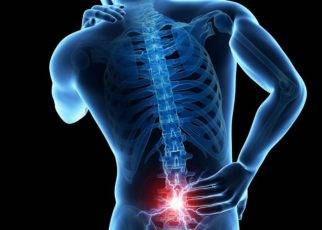 Best Ways to Prevent and Treat Holiday Back Pain 1