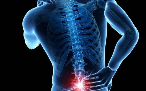 Best Ways to Prevent and Treat Holiday Back Pain 1