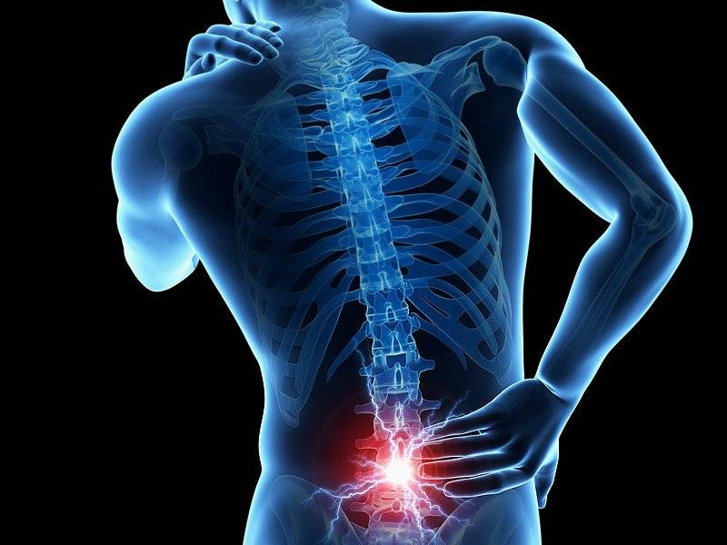 Best Ways to Prevent and Treat Holiday Back Pain 1