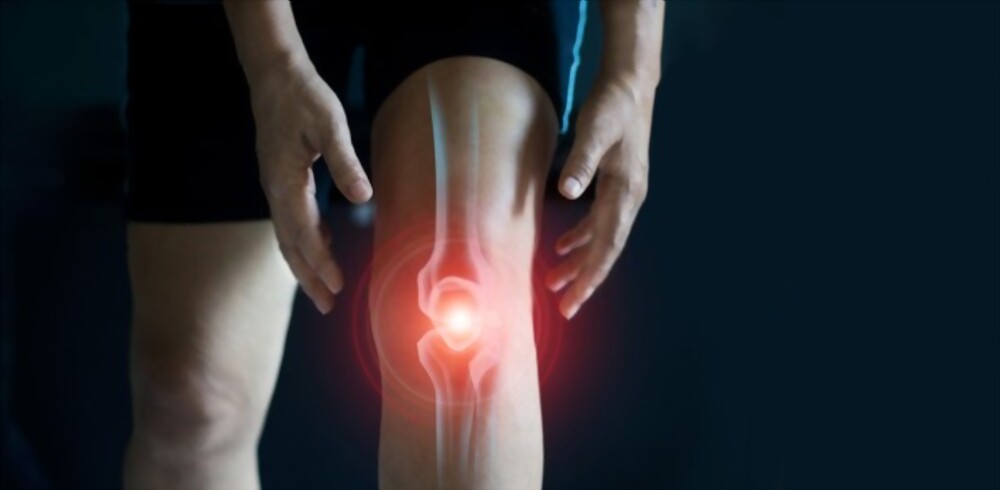 arthritis knees