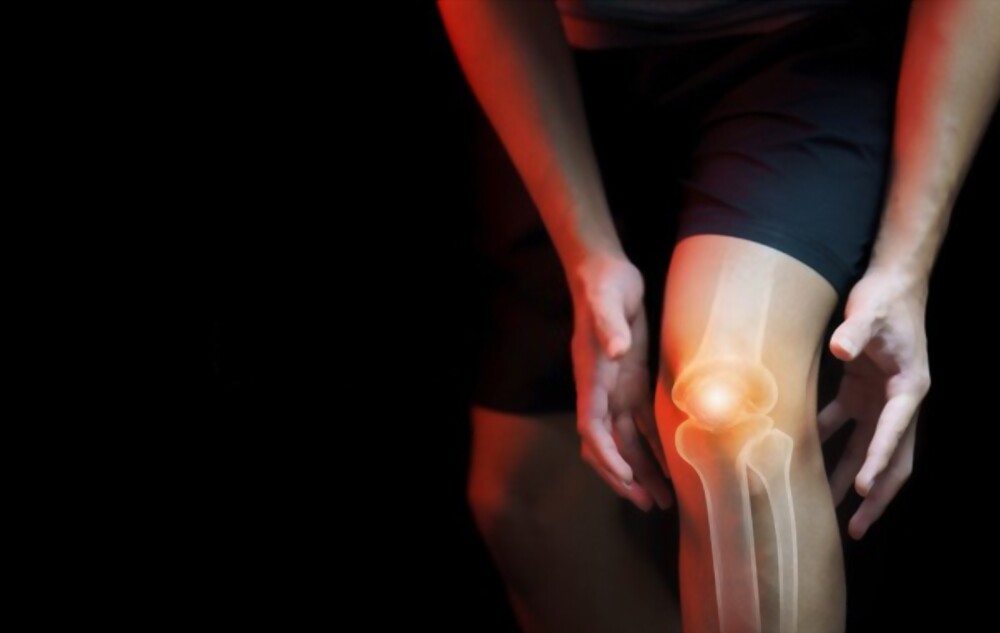 knees arthritis