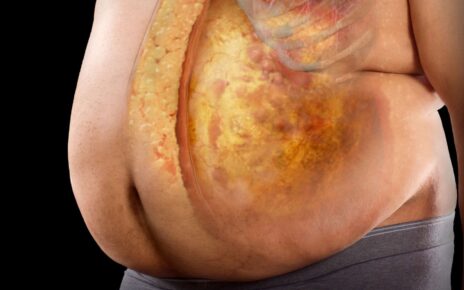 What Are The Warning Signs Of Obesity