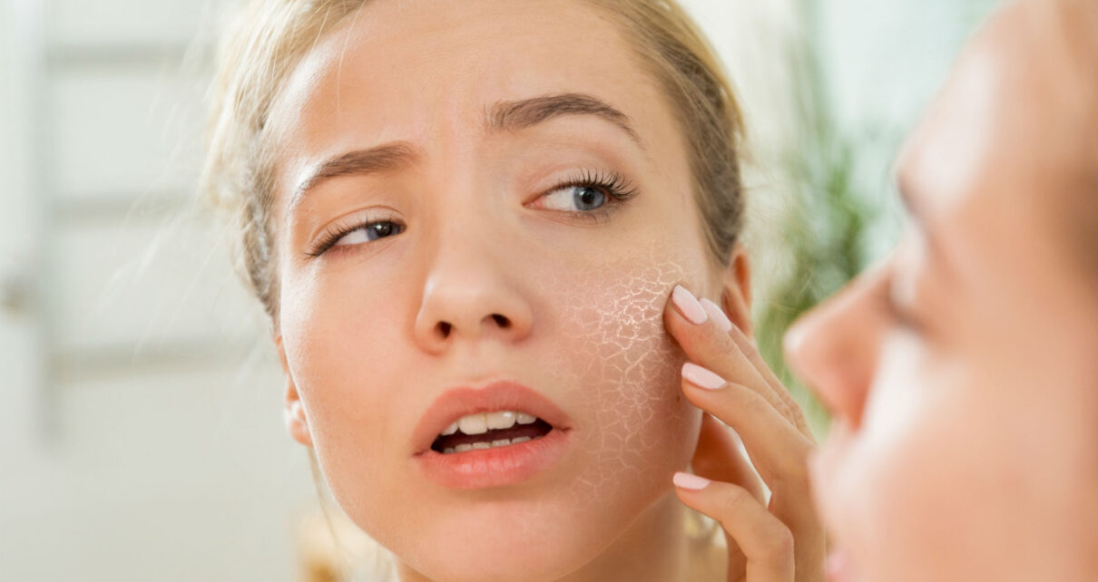 Winter Is Here: Give Your Skin Enough Vitamin E To Be Hydrated