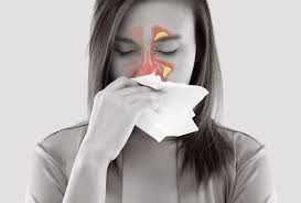 Sinus Infection: Symptoms, Causes, and Treatment