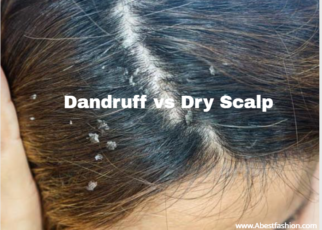 dandruff vs dry scalp