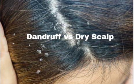 dandruff vs dry scalp