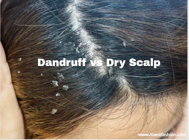 dandruff vs dry scalp